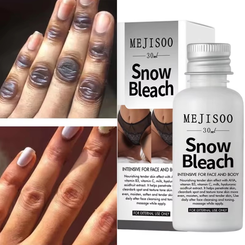 Korean Lifestyle Products - Snelwerkende Whitening Crème voor Donkere Knokkels,