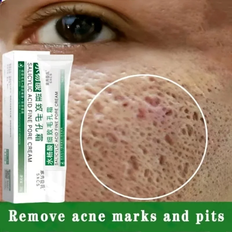 Korean Lifestyle Products - Salicylzuur Porie Clearing Cream Krimpen Poriën