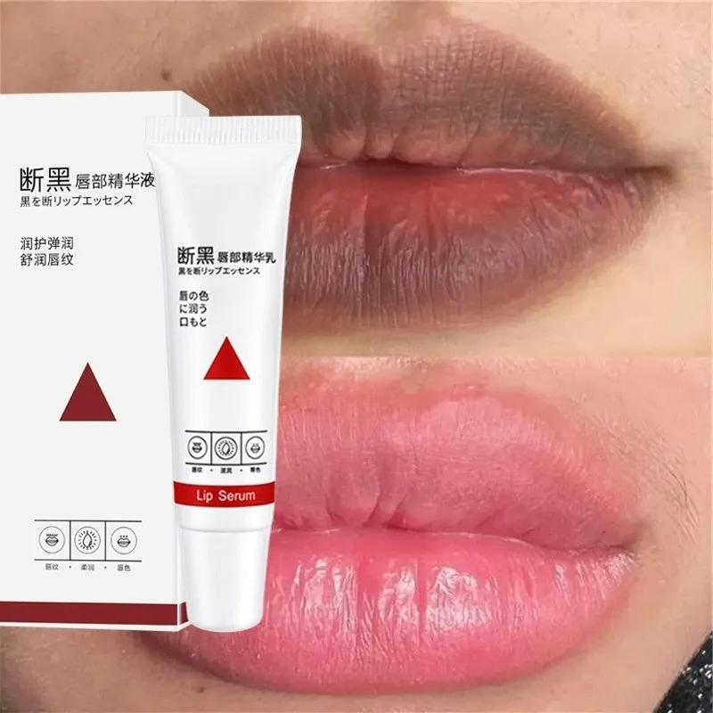 Korean Lifestyle Products - Verwijder Donkere Lippenbalsem Snelle Lichtmakende Roze