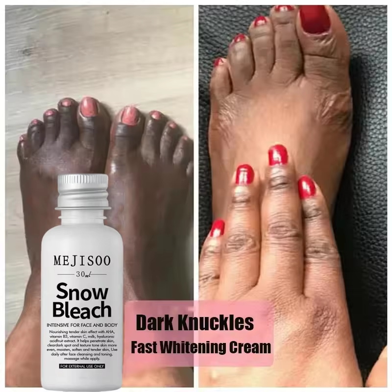 Snelwerkende Whitening Crème v - Korean Lifestyle Products recensie en prijs