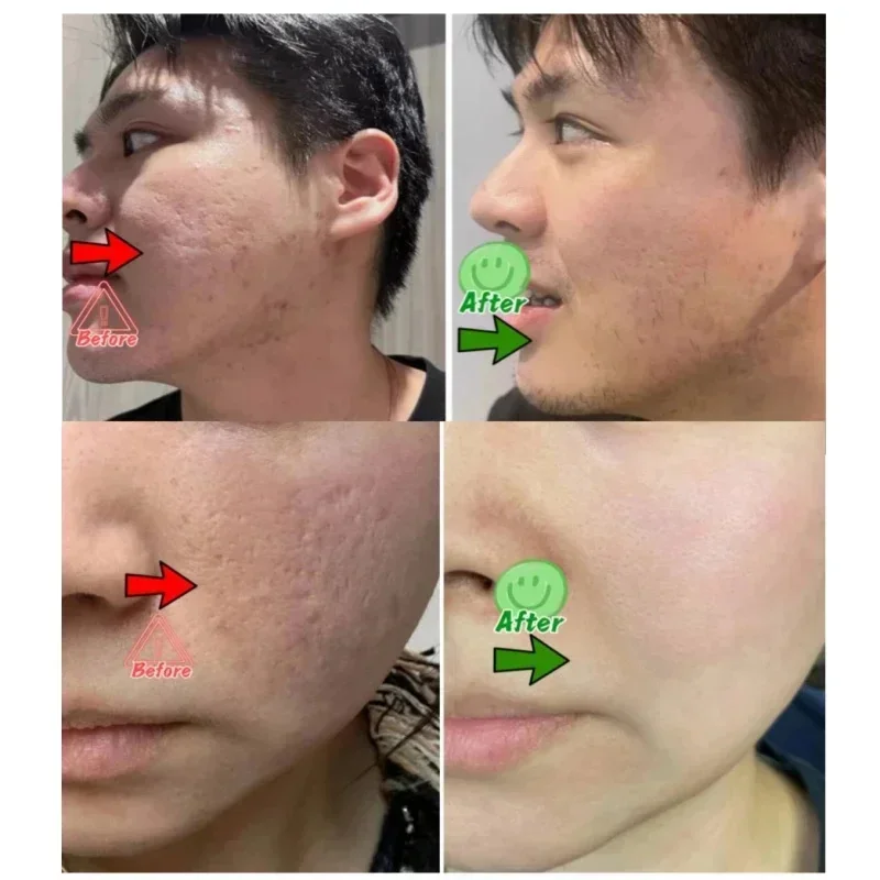 Salicylzuur Porie Clearing Cre - Korean Lifestyle Products recensie en prijs