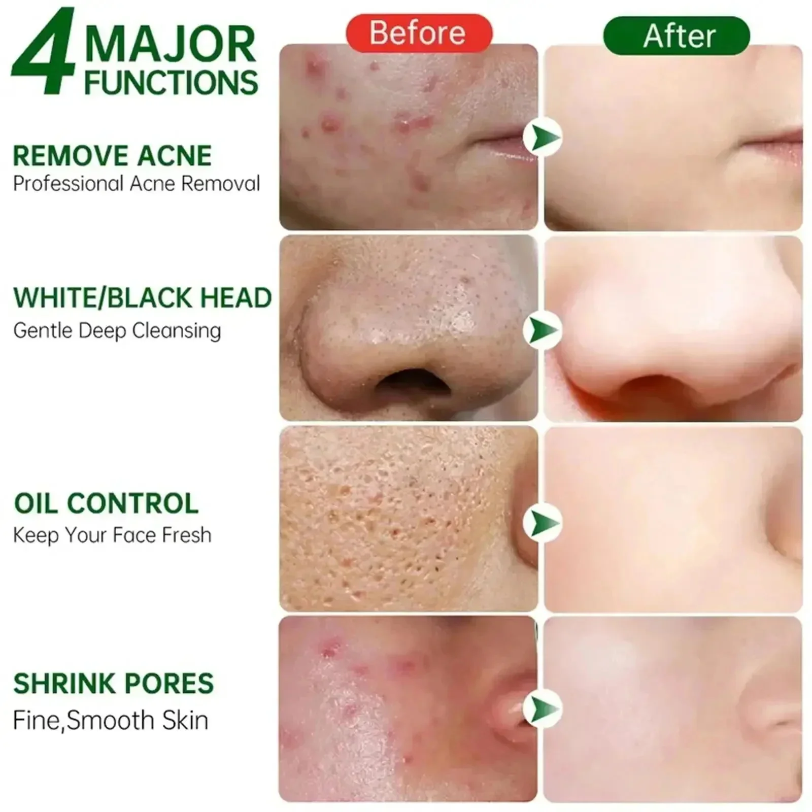 Salicylzuur Porie Clearing Cre - Korean Lifestyle Products recensie en prijs