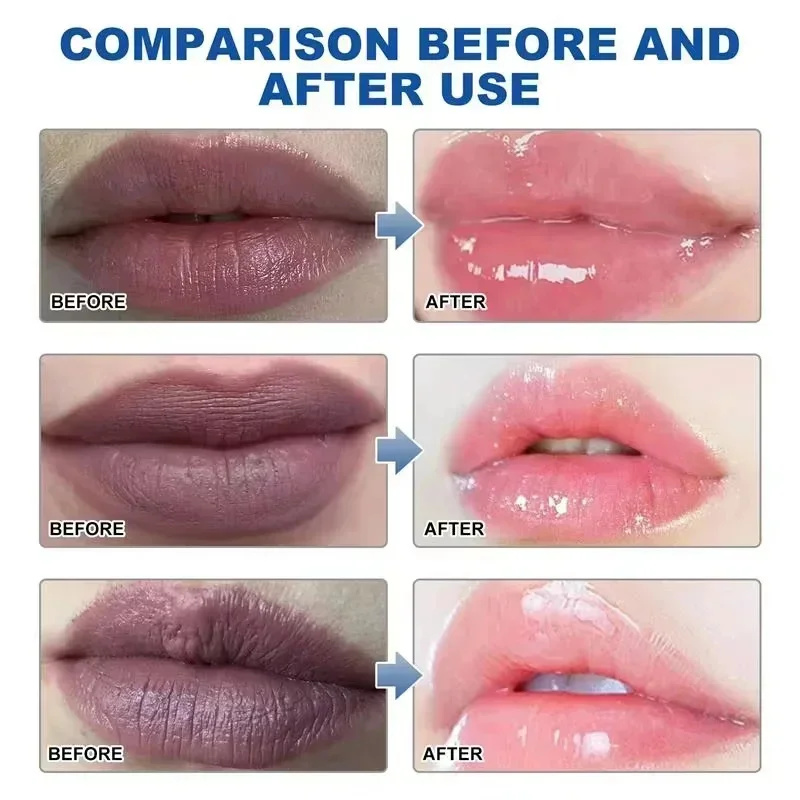 Verwijder Donkere Lippenbalsem - Korean Lifestyle Products recensie en prijs