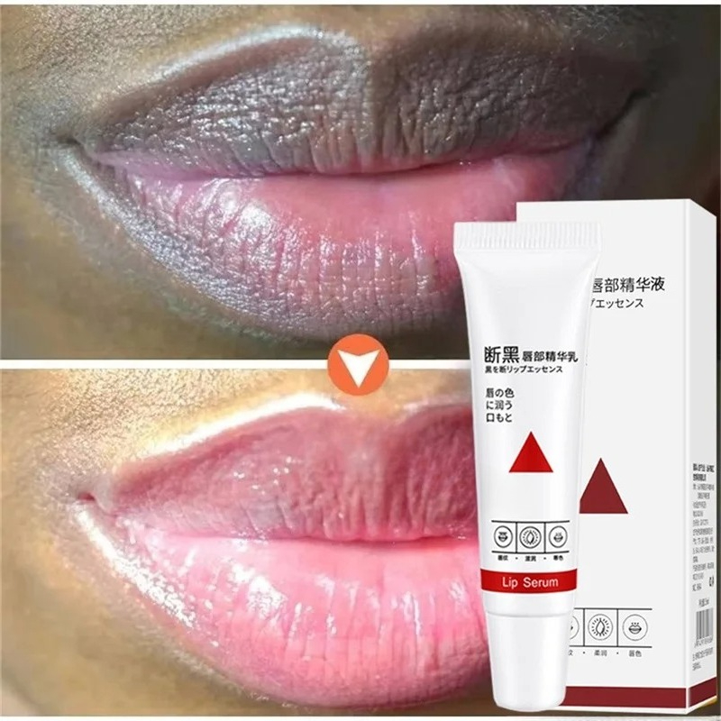 Verwijder Donkere Lippenbalsem - Korean Lifestyle Products recensie en prijs