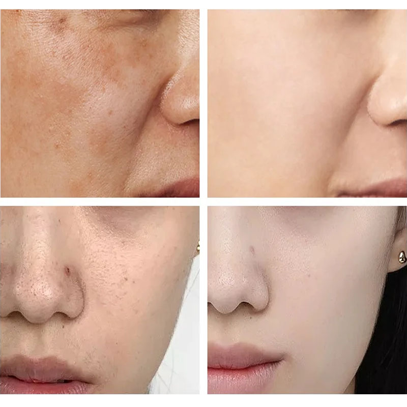 SPF90+ Zonnebrandcrème Koreaan - Korean Lifestyle Products recensie en prijs