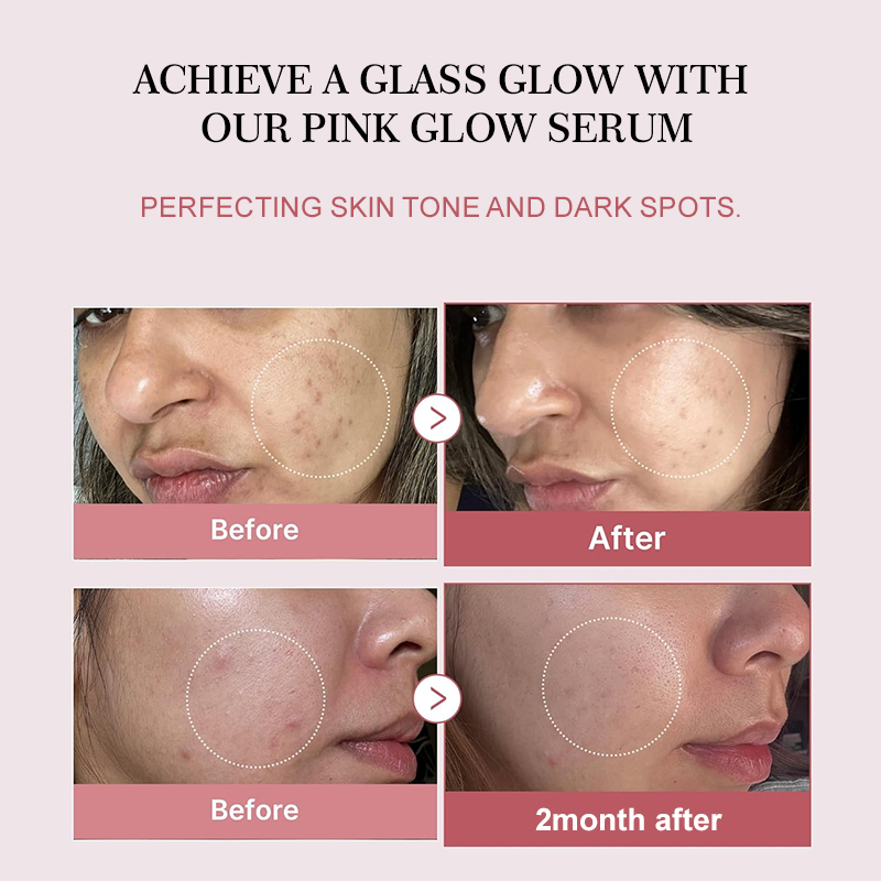 Zalm PDRN Collageen Peptide Ge - Korean Lifestyle Products recensie en prijs