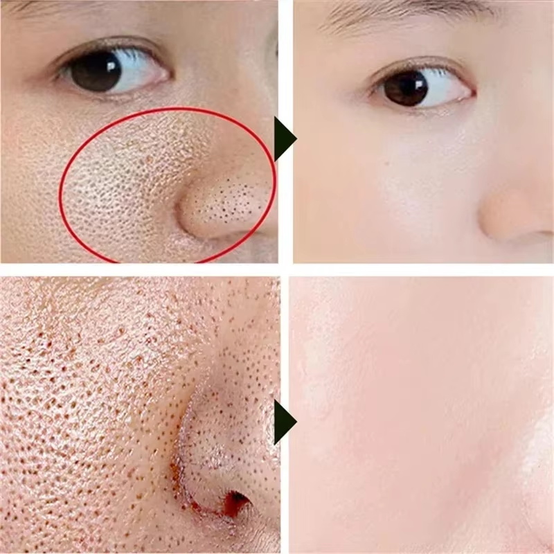 Salicylzuur poriënverfijnende  - Korean Lifestyle Products recensie en prijs